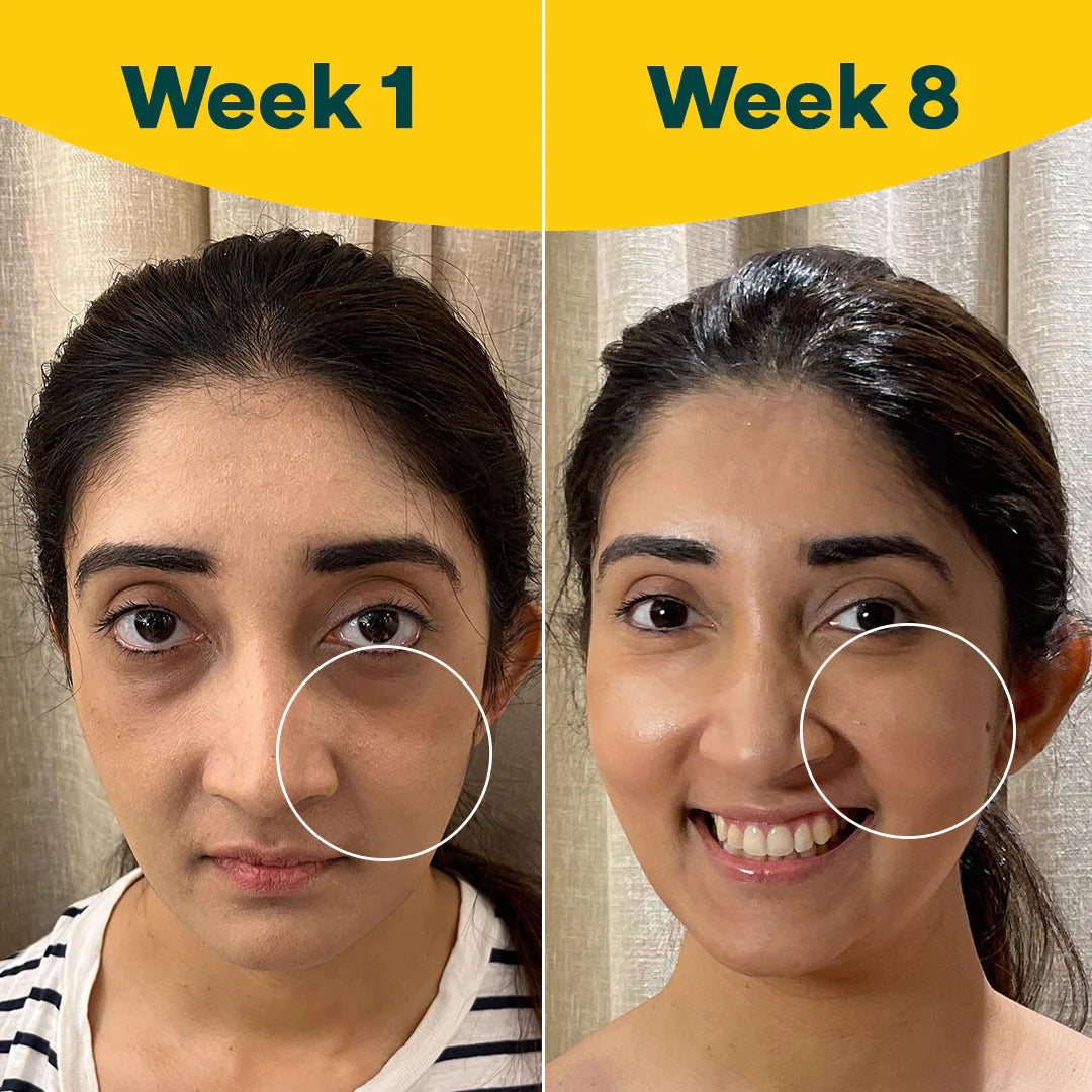 OZiva Plant Based Collagen Builder (with Silica, Vitamin C, Biotin) for Anti-Aging Beauty, 250 g